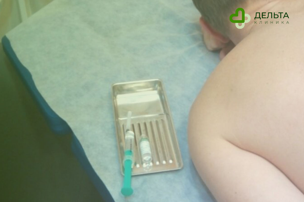 Мужчина после процедуры